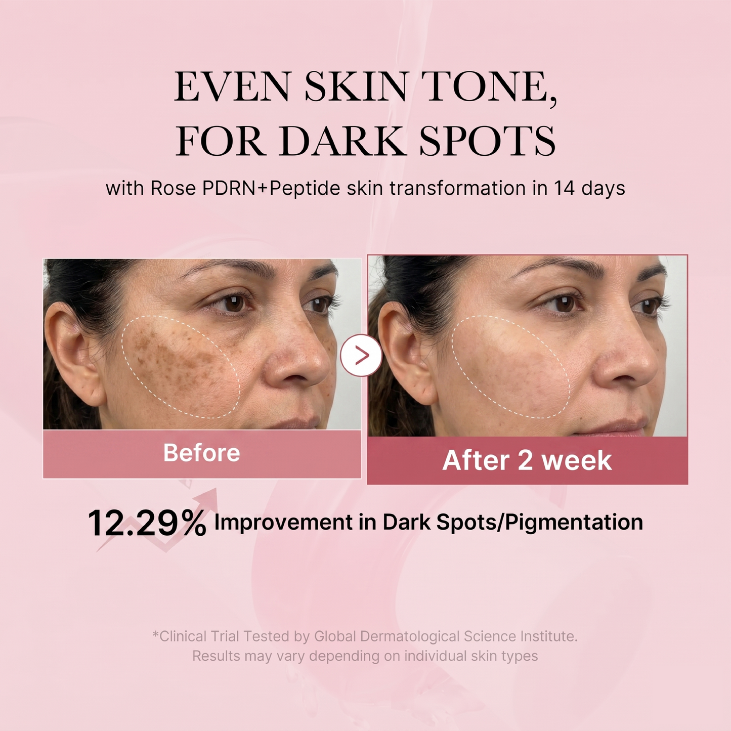 PDRN Pink Peptide Toner