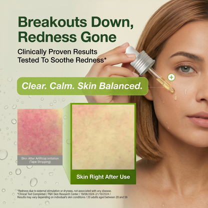 Azelaic Acid 10 Hyaluron Redness Soothing Serum