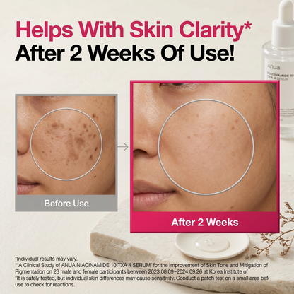 Niacinamide 10 TXA 4 Serum for Brightening and Dark Spots