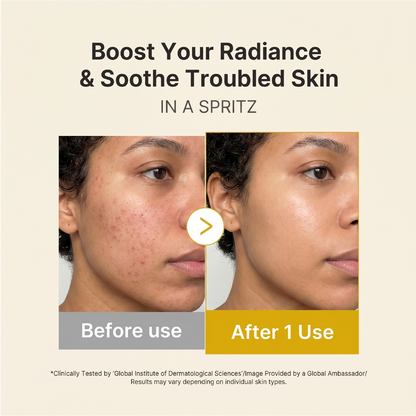 Kojic Acid Turmeric Vitamin Gold Jelly Mist Serum